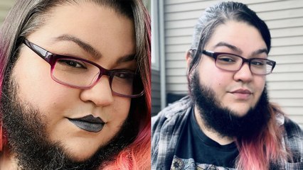 Beautiful Woman Grows BEARD After Ditching Razor!