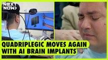 Quadriplegic moves again with AI brain implants | NEXT NOW