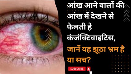 EYE FLU  आँखों में देखने से फैलता है , कितना सच है यह ? | CONJUCTIVITIS | EYE INFECTION | PINK EYES