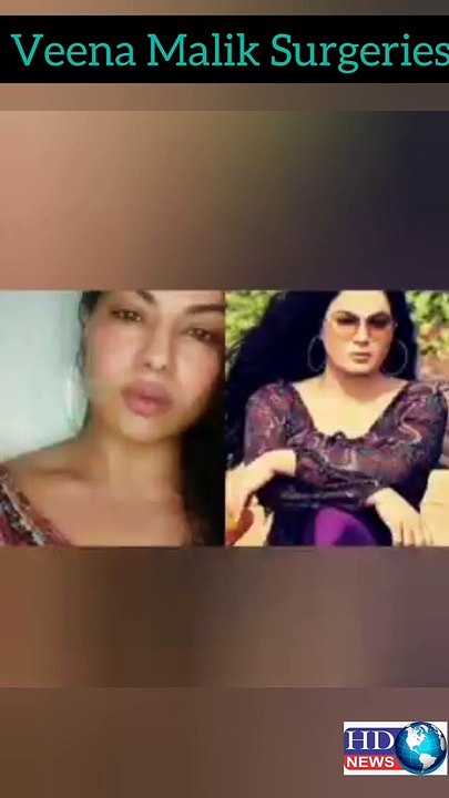 Veena Malik Got Face Surgeries #veena malik hot | veena malik hot songs | veena malik hot scenes