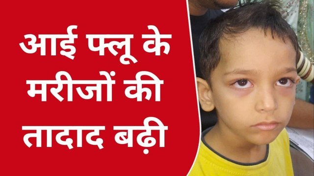 बीकानेर: तेजी से फैल रहा आई फ्लू, बच्चों का रखें ख्याल, बरतें ये सावधानी