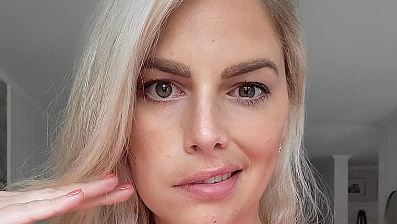 Angelina Kirsch postet neue Fotos von Gesichtslähmung: So geht es ihr jetzt