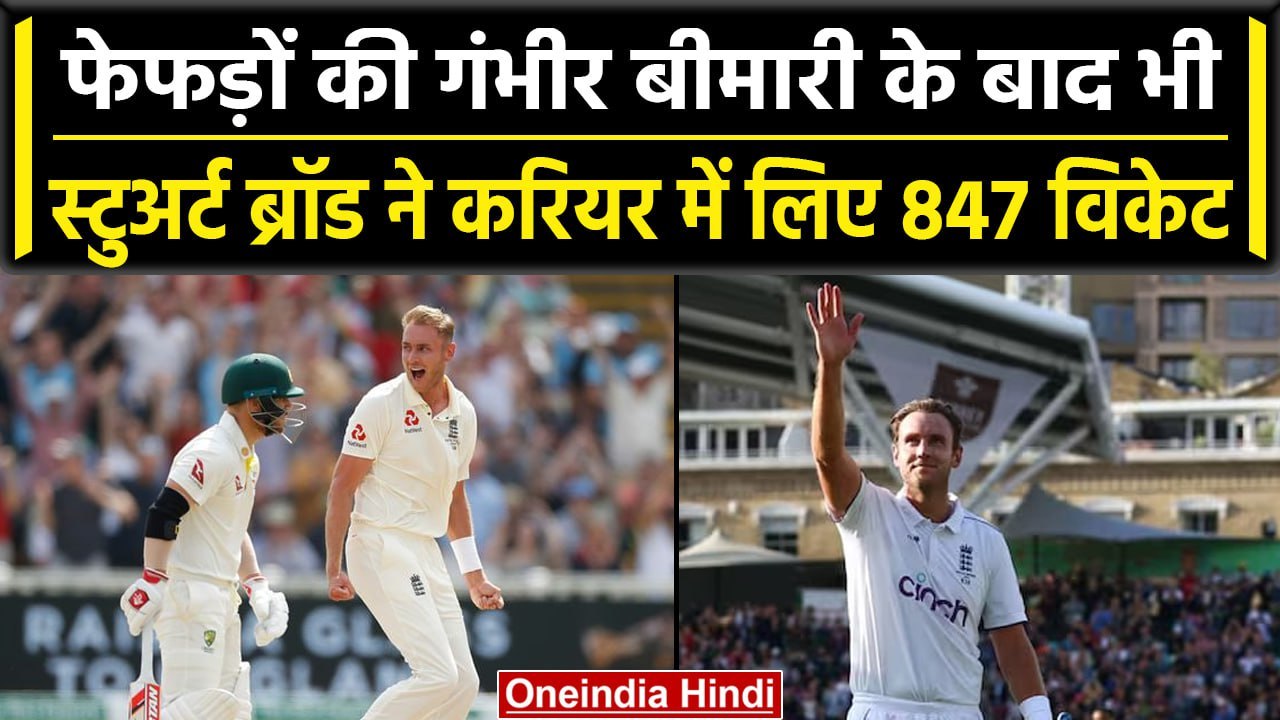 Sturat Broad Retirement: Broad को है ये गंभीर बीमारी, फिर भी बने दिग्गज गेंदबाज | वनइंडिया हिंदी