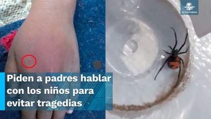 Niño se hizo picar por una viuda negra... para volverse Spiderman