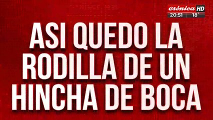 Incidentes en Montevideo: así quedó la rodilla de un hincha de Boca
