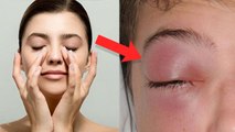 आंखों की मसाज कैसे करें | Eye Massage Kaise Kare | Boldsky