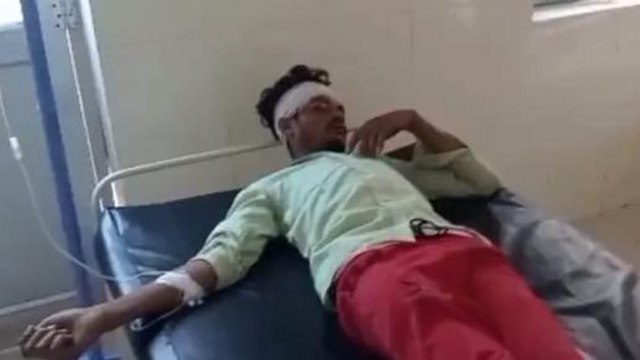 सीधी: भीषण दुर्घटना का शिकार हुआ बाइक चालक, दर्दनाक हादसे में युवक को फटा सिर