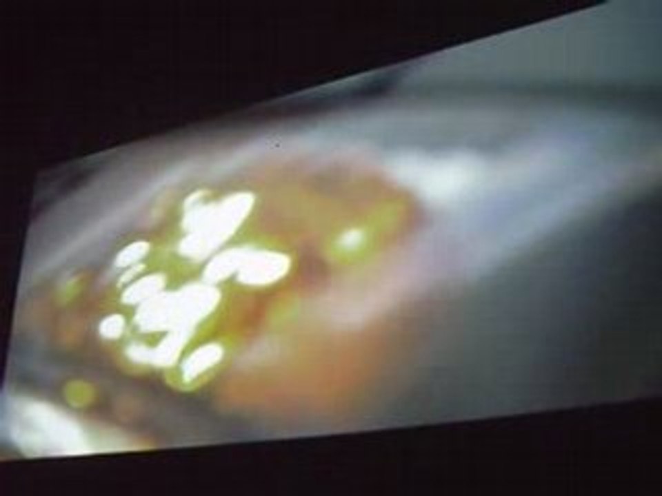 ZEMOS98 10a Pantallas paralelas miercoles