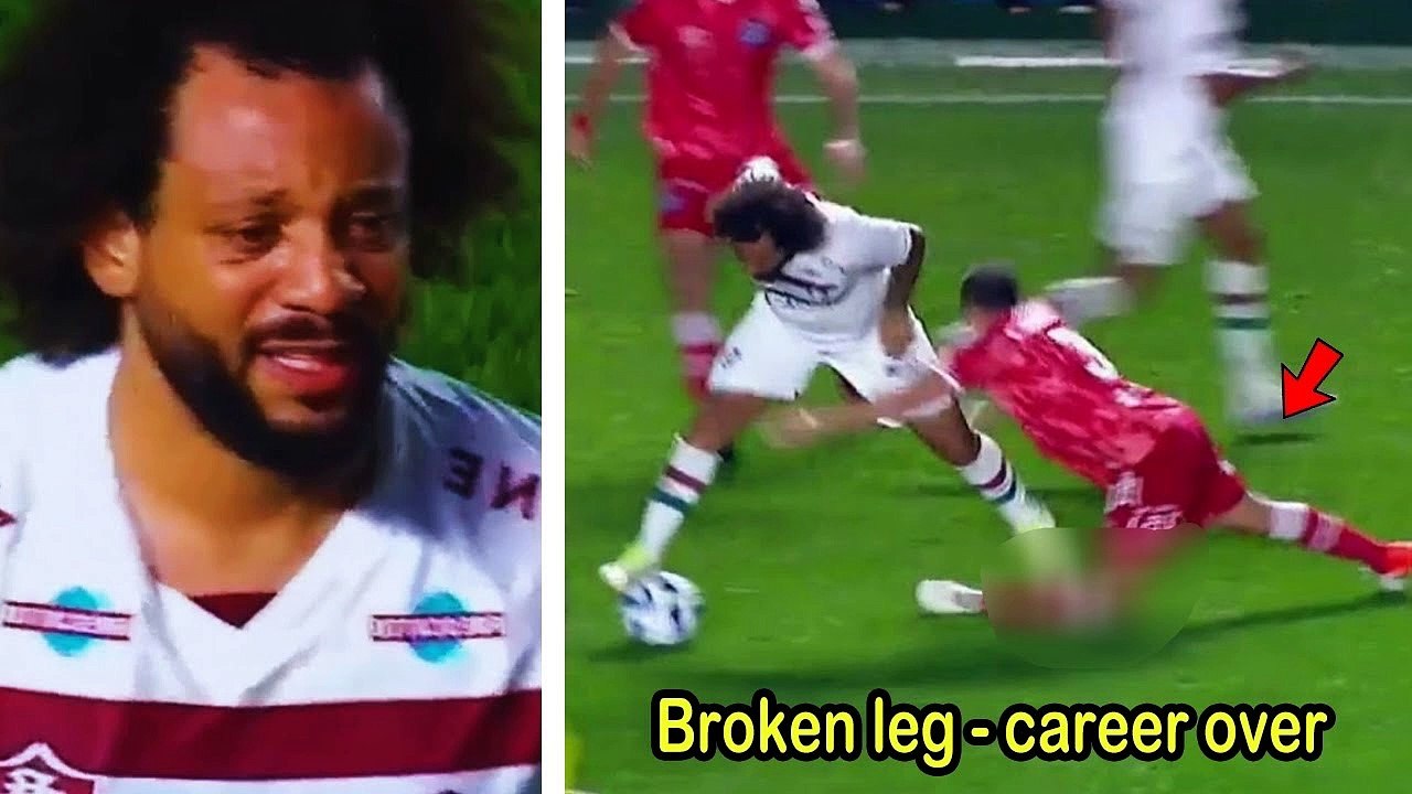 Marcelo BREAKS Player's Leg And Cries!