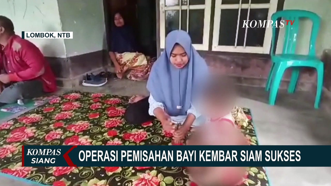 Operasi Pemisahan Bayi Kembar Siam Langka di NTB Berjalan 10 Jam