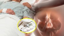 IVF Treatment में इस 1 Mistake से Burn हुआ Women Womb, Stomach में लगाया Acid Injection | Boldsky