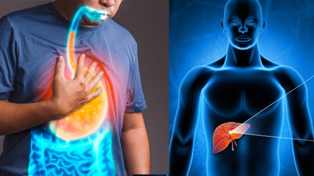 सीने में जलन क्यों होती है | Seene Mein Jalan Kyu Hoti Hai | Boldsky