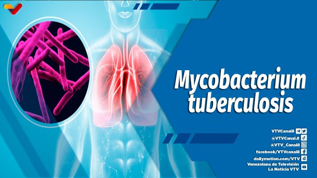 Actitud Saludable | ¿Qué es la tuberculosis y cómo puedo tratarla?