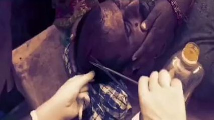 रोहतास: जमीन विवाद में दो पक्षों में हिंसक झड़प, फायरिंग में दो लोग घायल