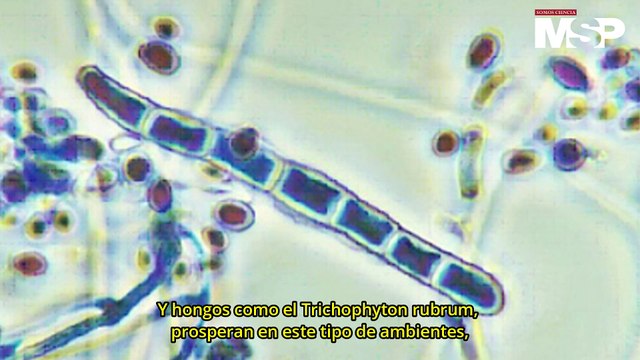 ¿Por qué nos dan hongos en las uñas? - #ExclusivoMSP