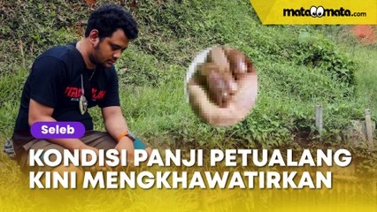 Kondisi Panji Petulang Mengkhawatirkan, Kurus Akibat Diabetes dan Patokan Ular Cobra