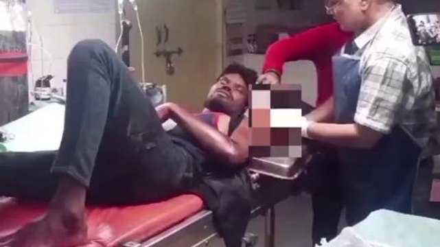 कटनी: यात्री पर अज्ञात बदमाशों ने किया चाकू से हमला, हाथ में फंसी चाकू