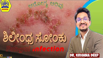 AAROGYA ARIVU ( HEALTH PROG. ) |  ಶಿಲೀಂಧ್ರದ ಸೋಂಕು [ FUNGAL INFECTION ] | DR.  KRISHNA DEEP