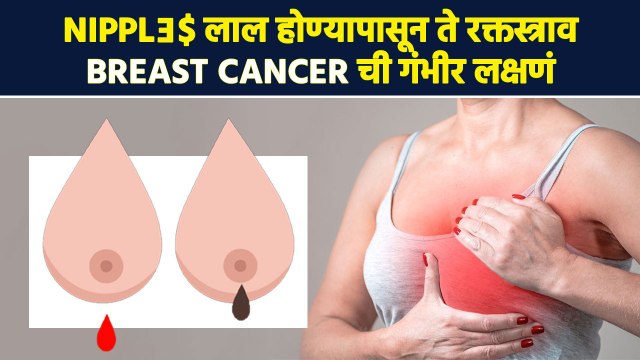 Breast मधून रक्त का येतं ? | Symptoms Of Breast Cancer | Women's Health | Lokmat Sakhi | RI2