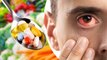 इस विटामिन की कमी से आई फ्लू कैसे होता है  | Is Vitamin Ki Kami Se Eye Flu Kaise Hota Hai |