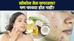 खोबरेल तेल लावण्याआधी हे पाहा  | Coconut Oil Benefits | Lokmat Sakhi | AI2