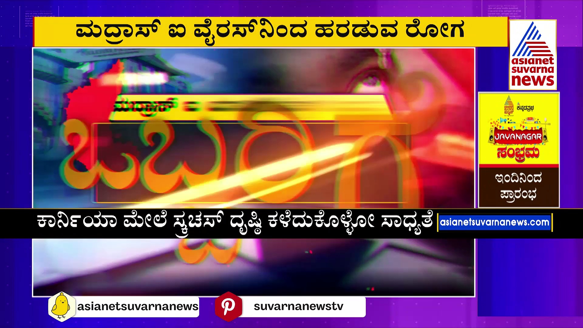 ಕರುನಾಡಲ್ಲಿ ಜೋರಾಗಿದೆ ಮದ್ರಾಸ್ ಐ ಆರ್ಭಟ: ರಾಜ್ಯದಲ್ಲಿ 40 ಸಾವಿರಕ್ಕೂ ಹೆಚ್ಚು ಕೇಸ್ ದಾಖಲು 