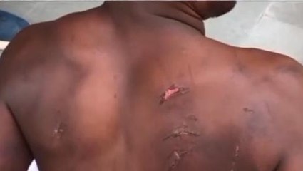 सिंगरौली: पेड़ से बांधकर युवक को जमकर पीटा,देखें आरोप