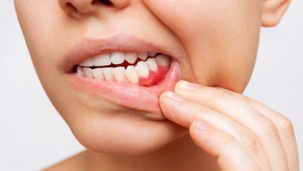 bd-salud-dental-110823