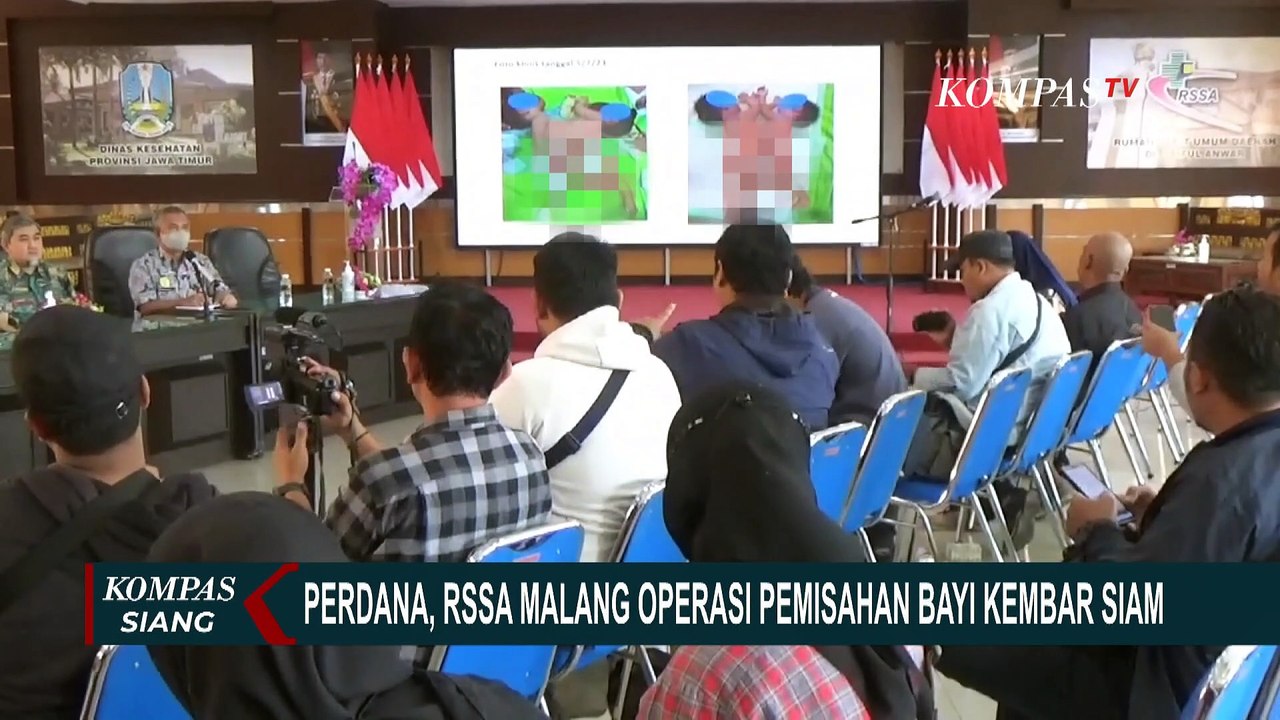 Libatkan Dokter dari Berbagai Disiplin Ilmu, RSSA Malang Operasi Pemisahan Bayi Kembar Siam!