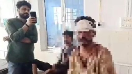 सीधी: खौफनाक था वो मंजर,भीषण सड़क हादसे को लेकर चश्मदीद ने सुनाई आपबीती