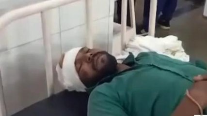 उज्जैन: कलयुगी भाई ने भाई पर किया जानलेवा हमला