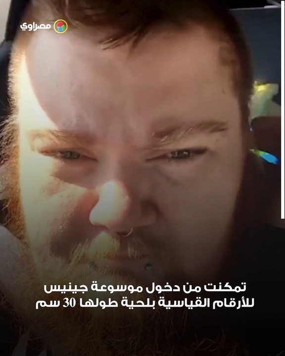 إيرين هانيكوت.. انضمام صاحبة أطول لحية في العالم لموسوعة جينيس