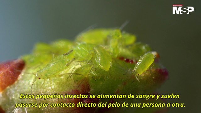 ¿Los piojos transmiten enfermedades en los niños? | #EspecialMSP