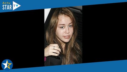 Acné  Une étrange et dangereuse technique fait fureur sur TikTok, convulsions, coma