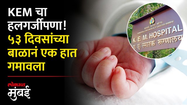 केईम रुग्णालयात ५३ दिवसांच्या बाळाचा एक हात काढला | KEM Hospital's Negligence! | Lokmat Mumbai