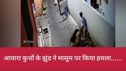 5 कुत्तों का 7 साल के बच्चे पर अटैक, नोंच-नोंचकर बनाया ये हाल , देखें वीडियो
