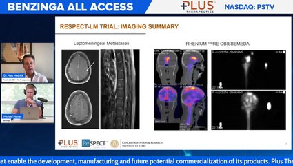 Plus Therapeutics Presents Exciting New Clinical Data At Top Cancer Conference