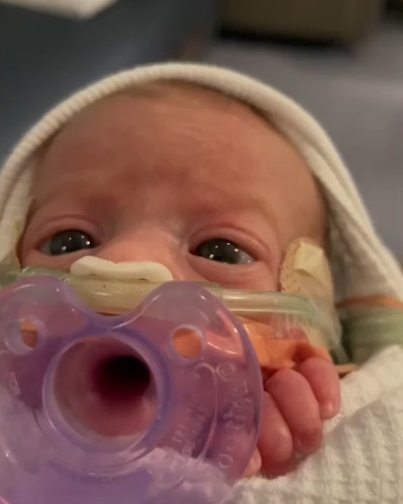 Tiny Twins Born 11 Weeks Early Defy Odds and Survive