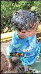 Niño hondureño padece de extraña enfermedad