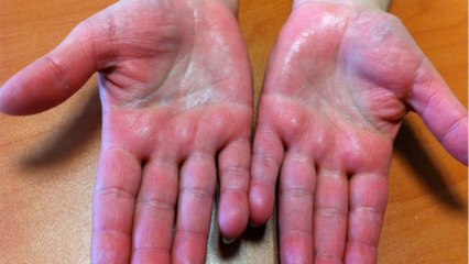 Covid-19 : une étude dévoile un symptôme que l’on ne soupçonnait pas