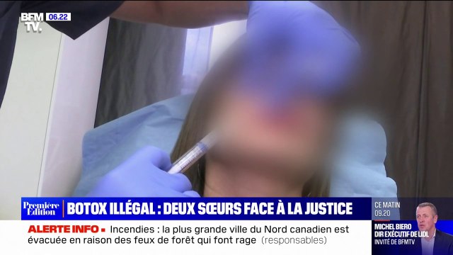 Deux sœurs soupçonnées d'injections illégales de botox jugées à partir de ce jeudi