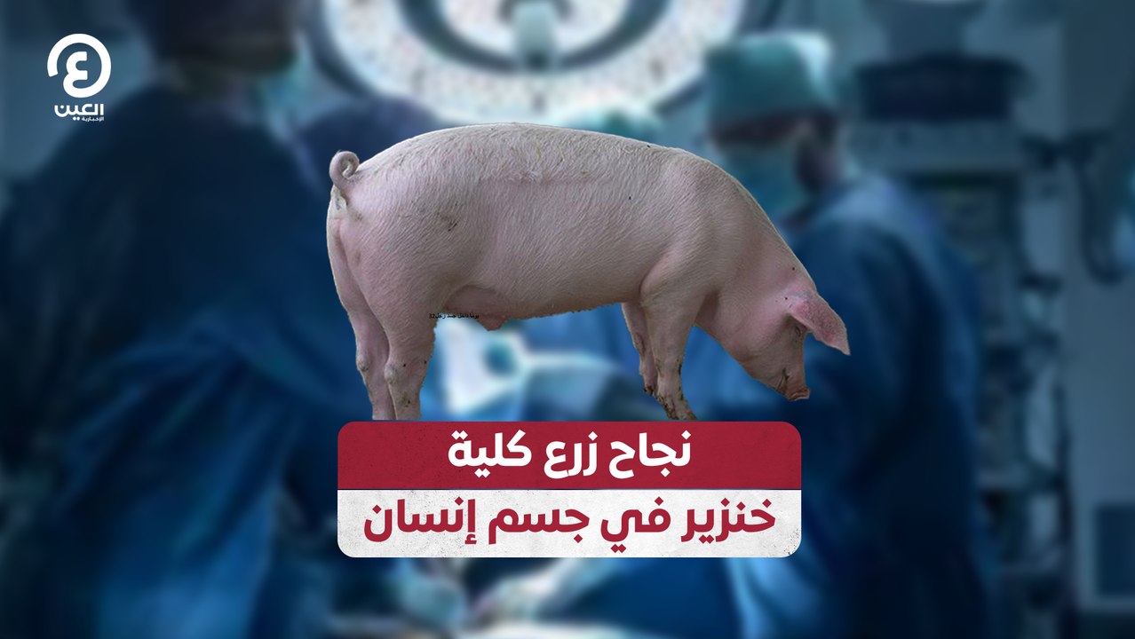 نجاح زرع كلية خنزير في جسم إنسان