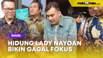 Ungkap Rujuk dengan Rendy Kjaernett, Hidung Lady Nayoan Bikin Gagal Fokus: Udah dari Dulu Gitu?