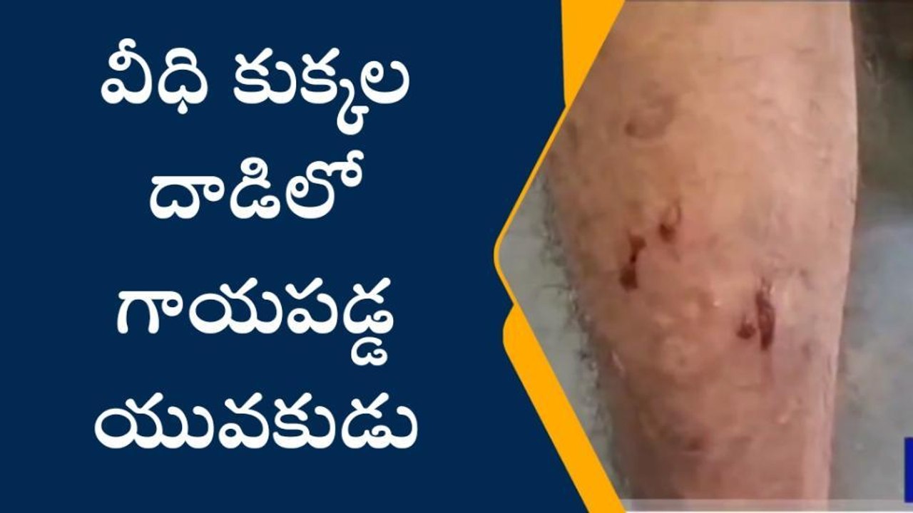 ఖమ్మం: వీధి కుక్కల దాడిలో వ్యక్తికి గాయాలు..!