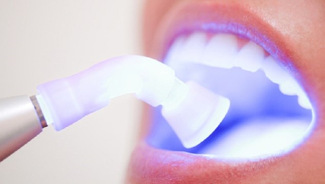 Cirurgião dentista explica se clareamento dental enfraquece os dentes
