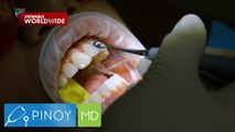 Pagkakaroon ng bunny teeth, ligtas nga ba? | Pinoy MD