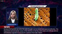 'Flesh-eating' bacteria Vibrio vulnificus bacteria kills 5 in Florida - 1breakingnews.com