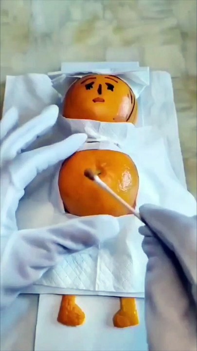 Funny Operation memes Trending going viral | Funny memes | Trending viral