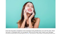 The Vanishing Act of Acne - Why Kids Don't Have Acne Anymore - nowmedical