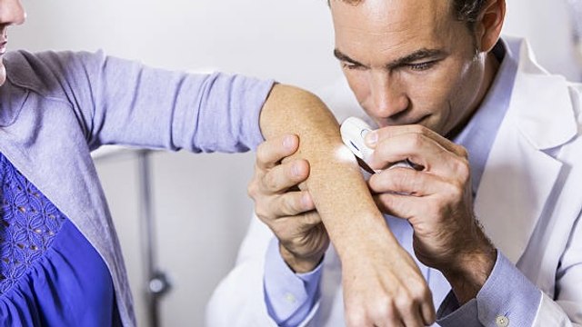 Debes Revisar Tu Piel Con Esta Frecuencia Para Evitar Tener Cáncer De Piel